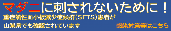 sfts_top