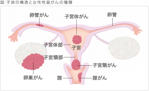 子宮の構造と女性性器がんの種類